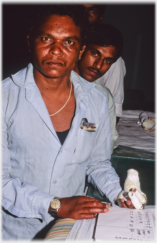 Man with plaster cast on thumb, two men behind him.